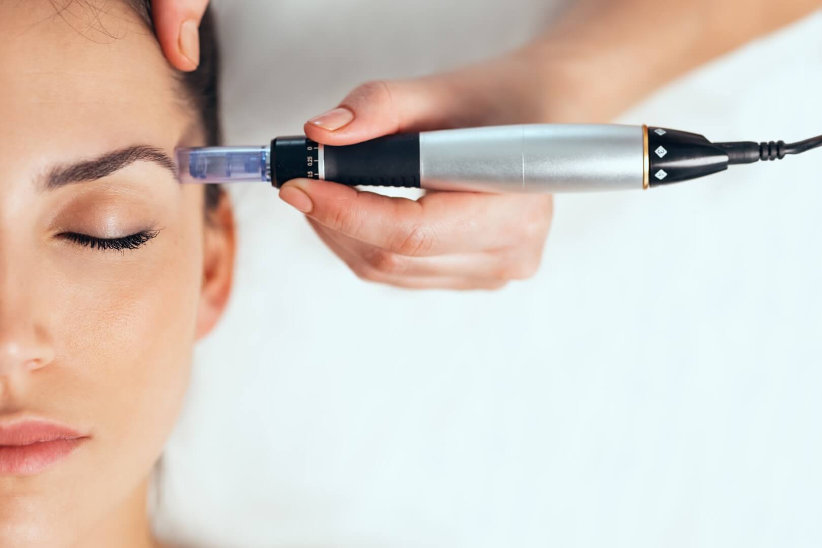Microneedling, PRP Microneedling, PRP