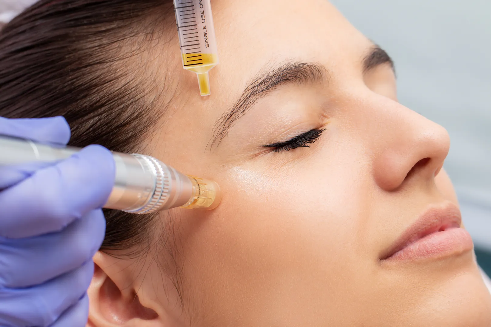 How does Microneedling work? How does Microneedling work?