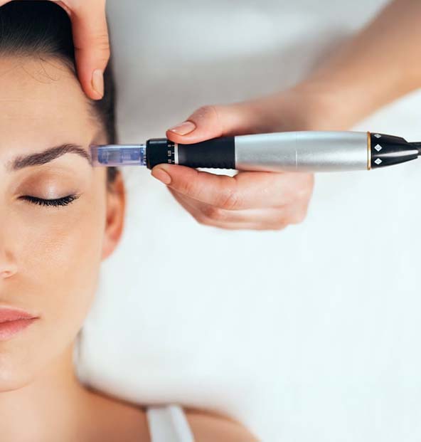 synergy-laser-microneedling-page-model-for-main-body-of-the-page Hyperhidrosis Treamtment in Temecula & Murrieta